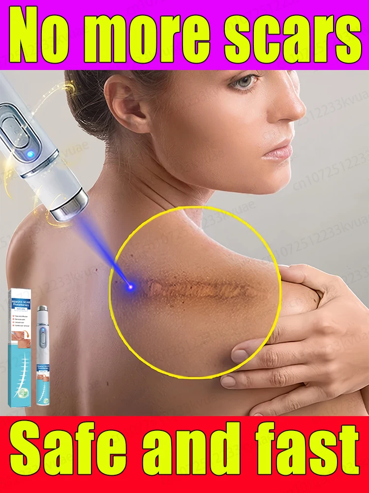 

Scar removal. Your skin care expert