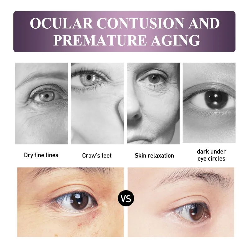 كريم مرطب مضاد للشيخوخة لتنعيم العين وتقليل التجاعيد للعيون الشبابية