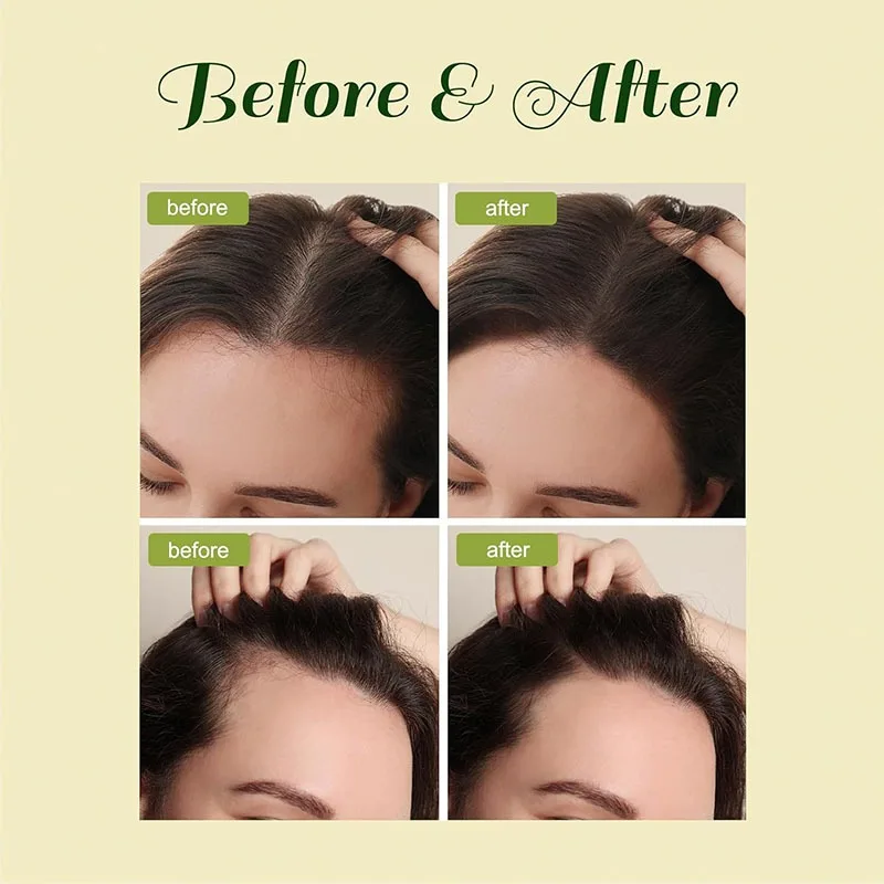 Olejek na porost włosów Naturalny olejek rozmarynowy Czysty, wegański, veganiczny olejek na porost włosów