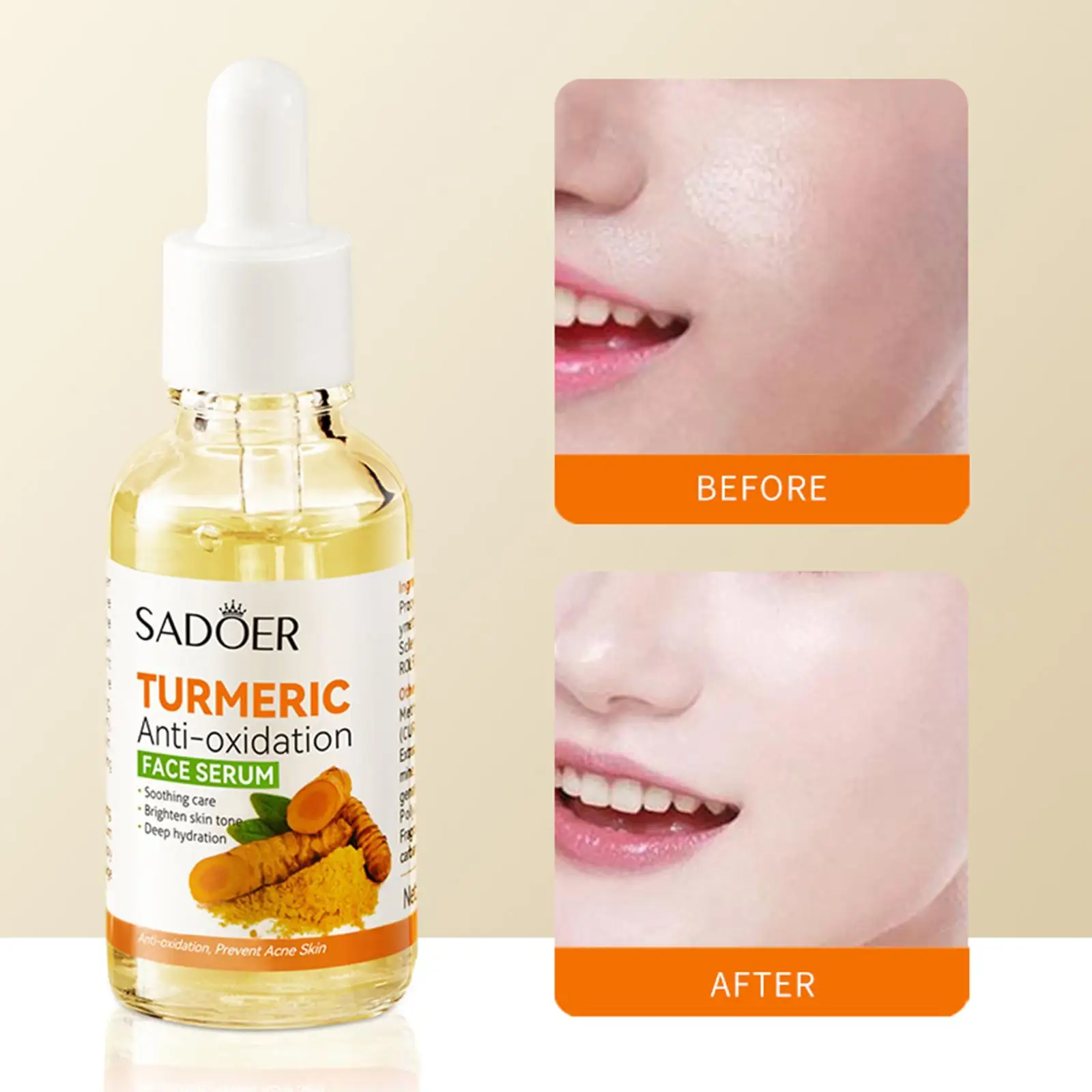 30ML Turmeric Face Serum Whitening Dark Spot Remover Acne Scar Bright Skin Corrector Facial Essence Improve Roughness