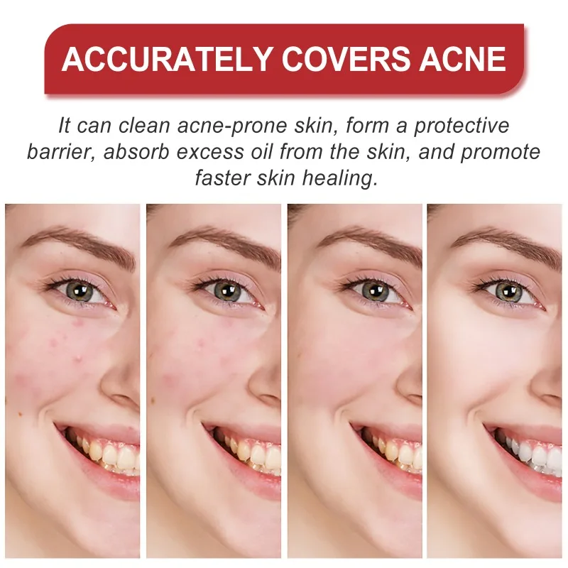 Star Acne Pimple Patch Yellow Star Shaped Absorbing Cover Patch Invisible Hydrocolloid Acne Patches for Face Acne Dots