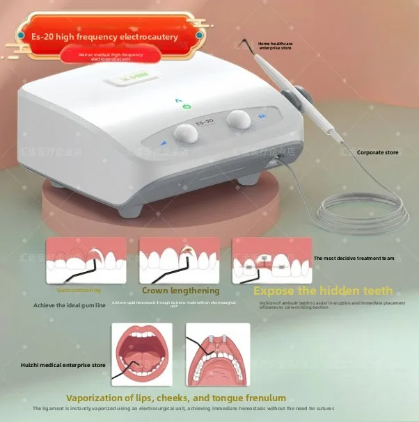 ES20 Electrosurgical Unit High Frequency Electrocautery Cutting Coagulation Multifunctional for Oral