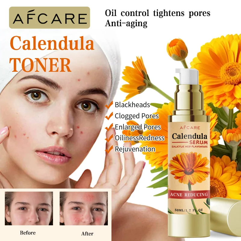 Women Calendula Serum Facial Essence Contains Salicylic Acid Repair Acne Serum Oil Shrink Pore Remove Blackheads Facial Cleaning