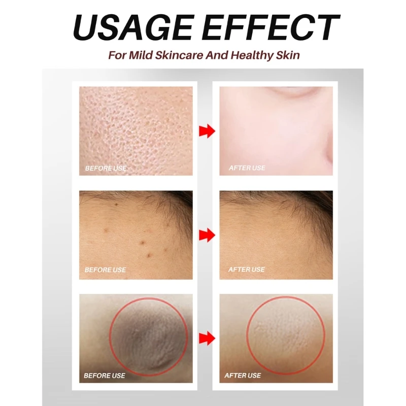 สบู่ดำแอฟริกัน Anti Rebelles Beauty Moisturizing Natural Bath Treatments Dropshipping