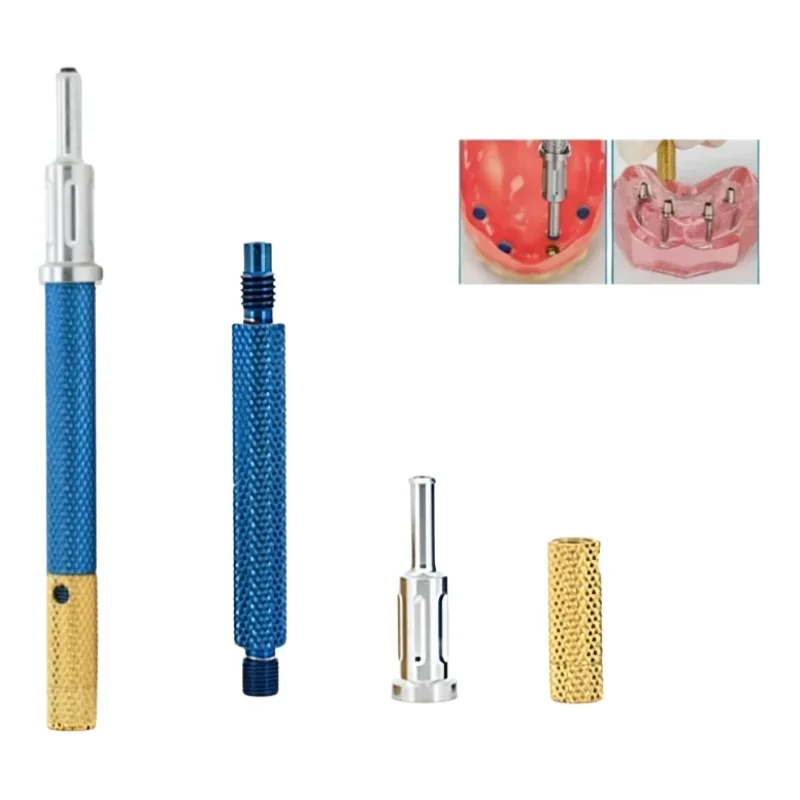 Dental Implant Core…