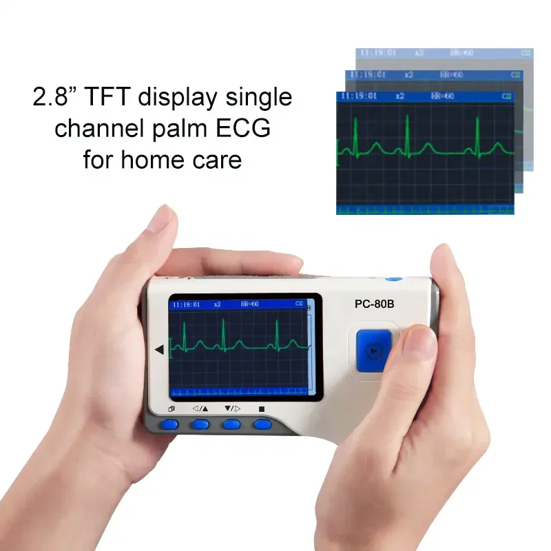 Viatom PC-80B Portable ECG Monitor Handheld LCD Heart Rate Tracker Single Leads ECG Health ECG Machine With Analyzer