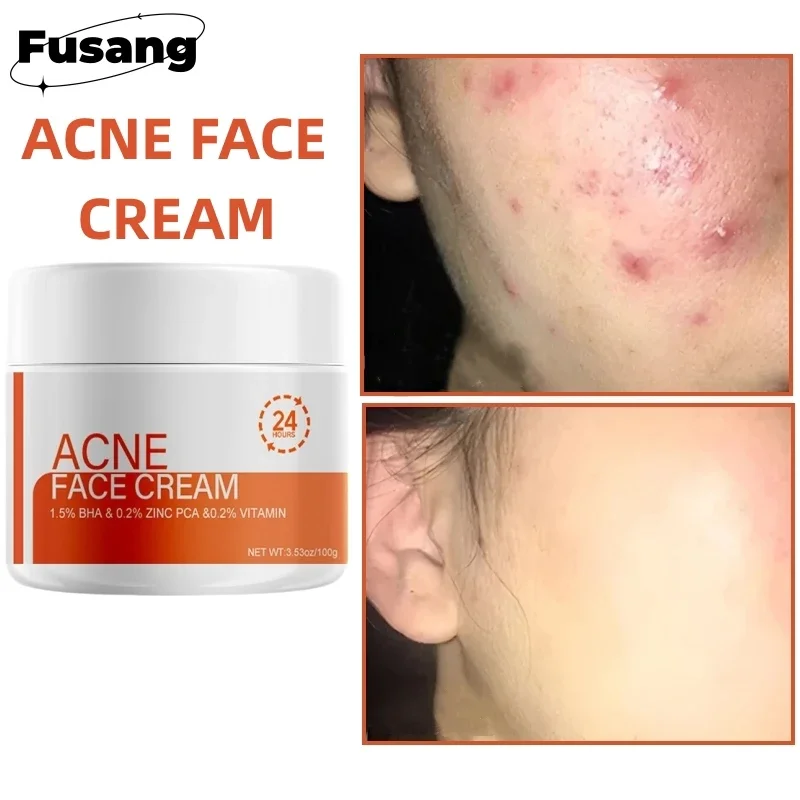 

Salicylic Acid Pore Shrinking Cream Reduce Large Pore Lifting Face Repair Rough Dull Pore Brighten Moisturize Skin Care