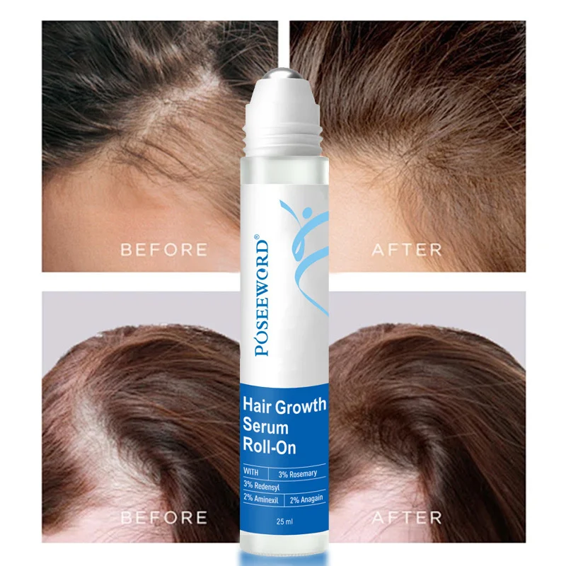 Rosemary Hair Care Serum Roller Ball Moisturizing Repairing Split Ends Strengthening Care For All Hair Types