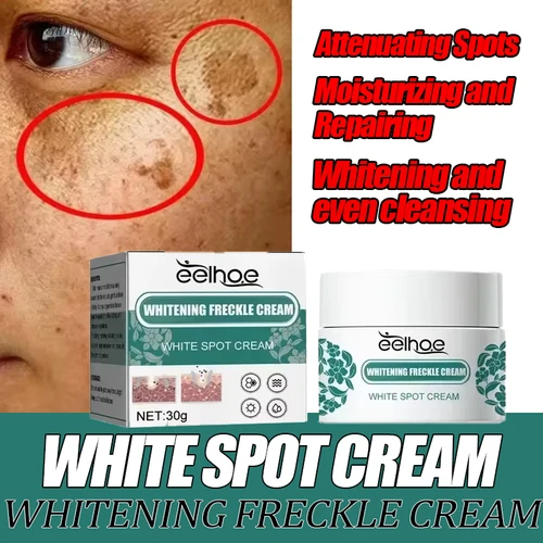Eelhoe niacinamida Melasma crema iluminadora Reduce la melanina crema iluminadora aclara la piel oscura suero de cloasma desvanece las líneas finas de la cara