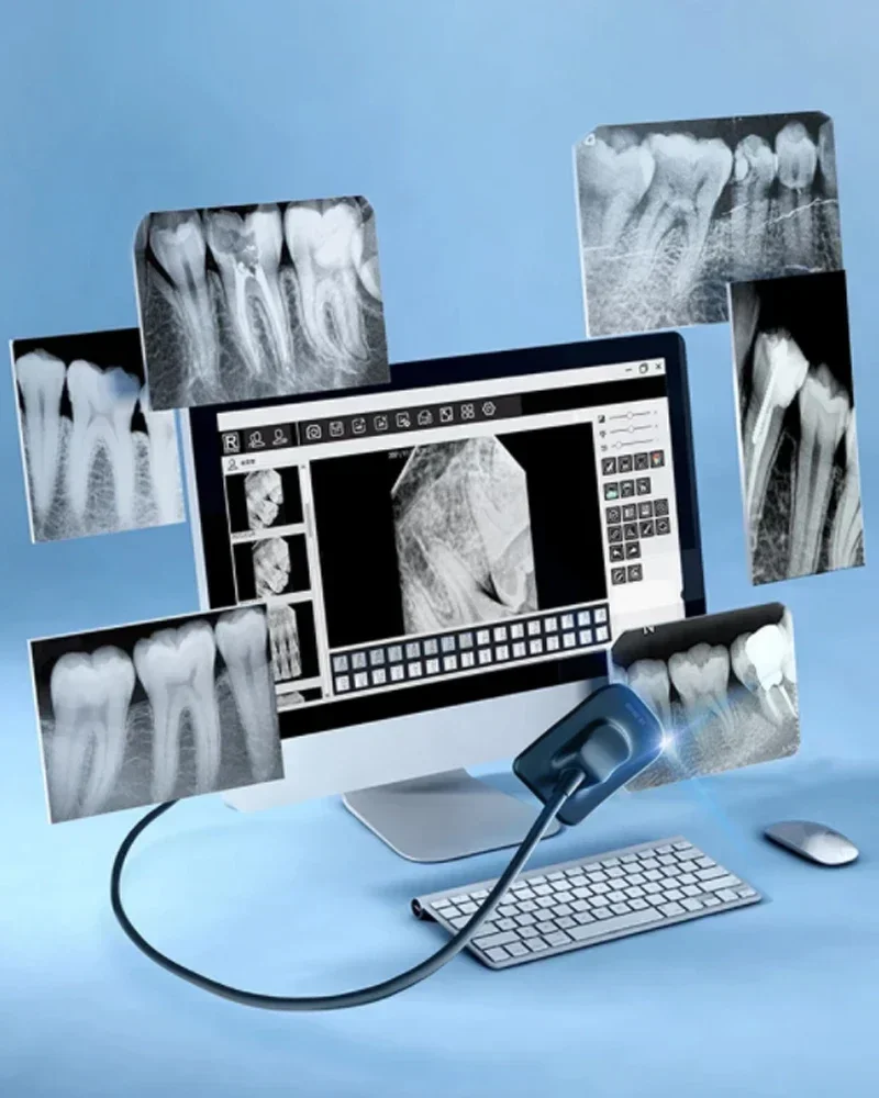 REFINE Dentals x-ray Sensor Radiovisograph