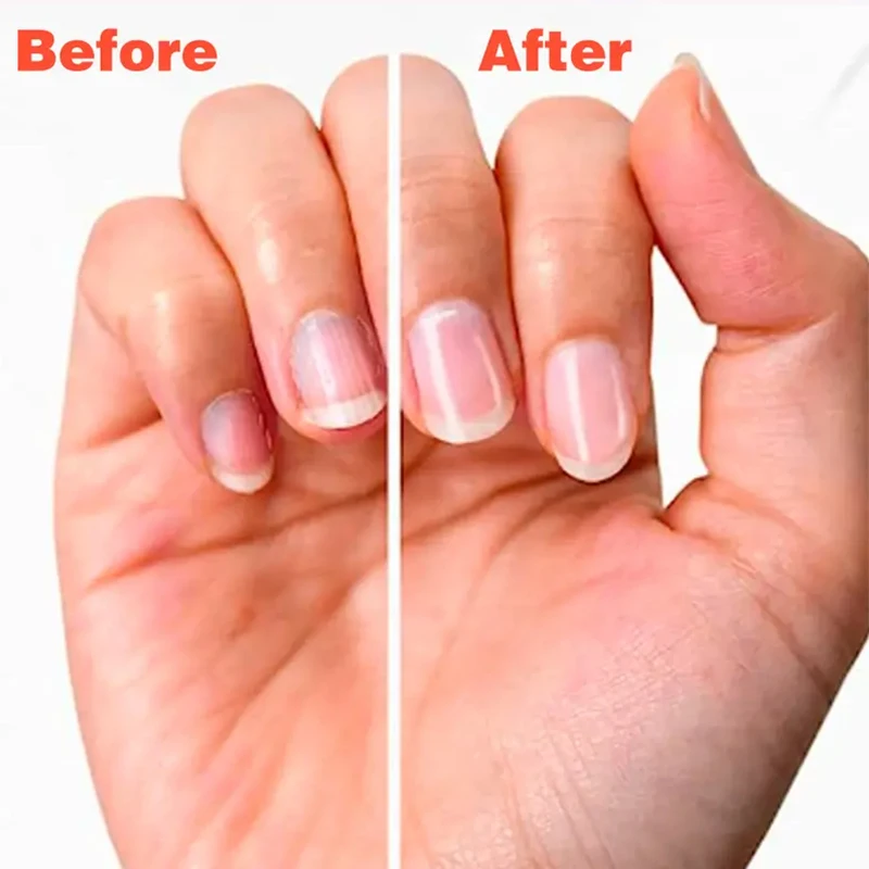 Nail Repair Fluid, Danificado e descolorido, Solução Fortalecida Unhas, Soro de unhas fortes e rápido crescimento, Essência Anti-frágil