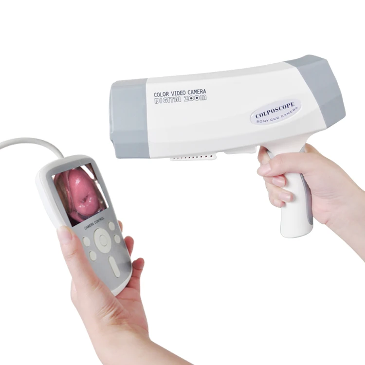 Colposcopy Machine Digital Video Colposcope for Gynecology Examination