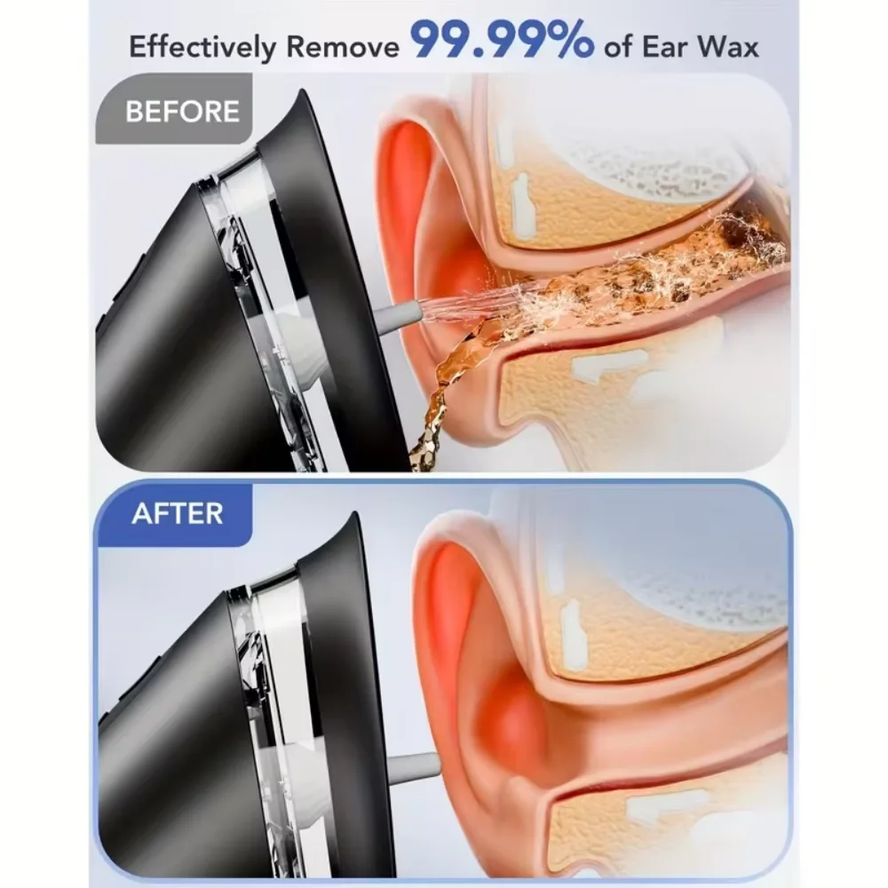 Thumbnail 3 - #66 Budget Wax Removal Kits for Smart Shoppers