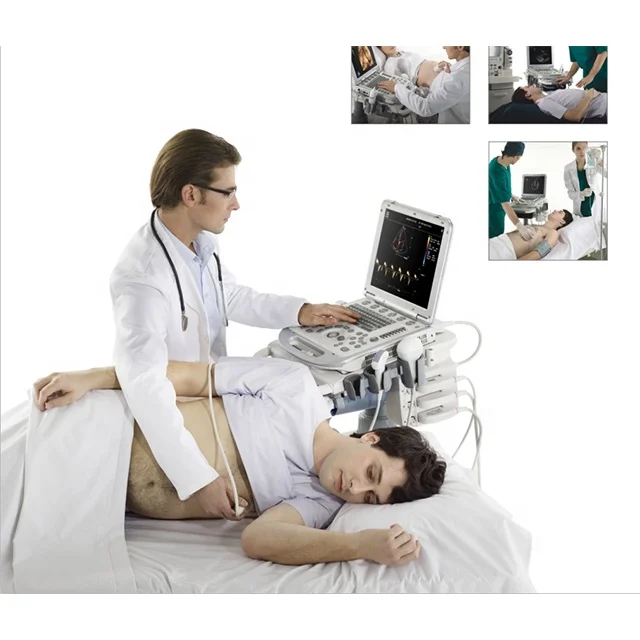 M7 Mindray Professional Portable 3D/4D Color Doppler Ultrasound Machine, ecografo mindray m5 m7 m9