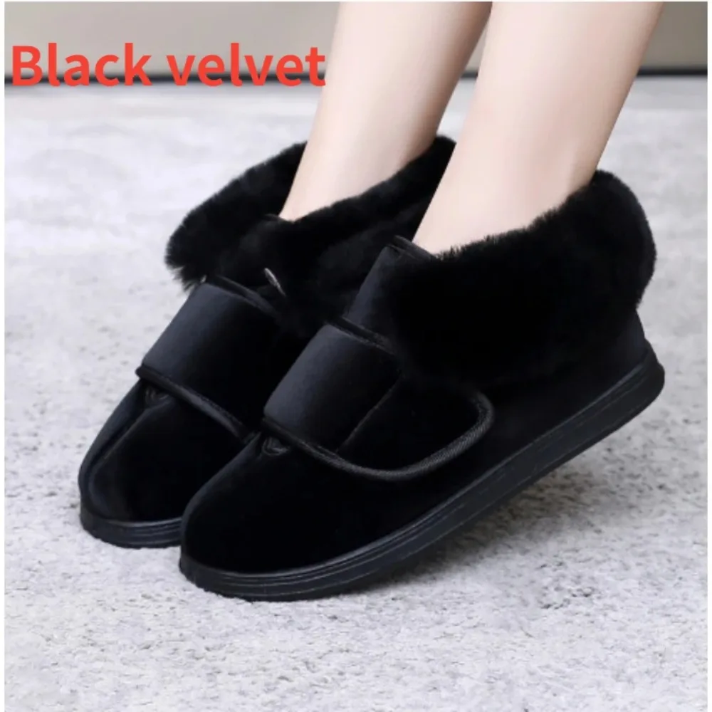 

Widened Diabetic Foot Shoes Winter Elderly Feet Fat Swelling Deformation Care Shoes Thicken Hallux Thumb Valgus Diabetes Shoes