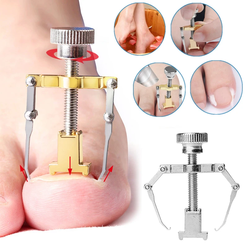 

Embedded Nail Corrector Stainless Steel Pedicure Tool Cure Paronychia Corrector Straightening Ingrown Toenails Toe Nail Fixer