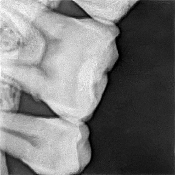 Dentl Radiography Sensor Denal Sensor De Rayos X Digital De tal Intraoral Rvg Sensor