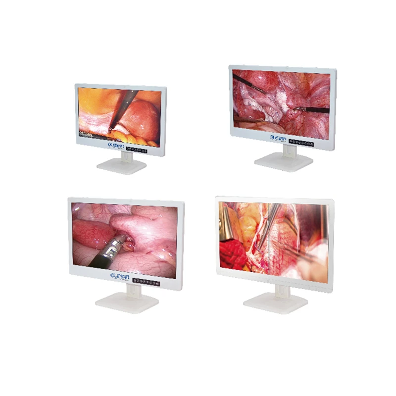 27 inch medical endoscopy  for endoscope  system surgical display