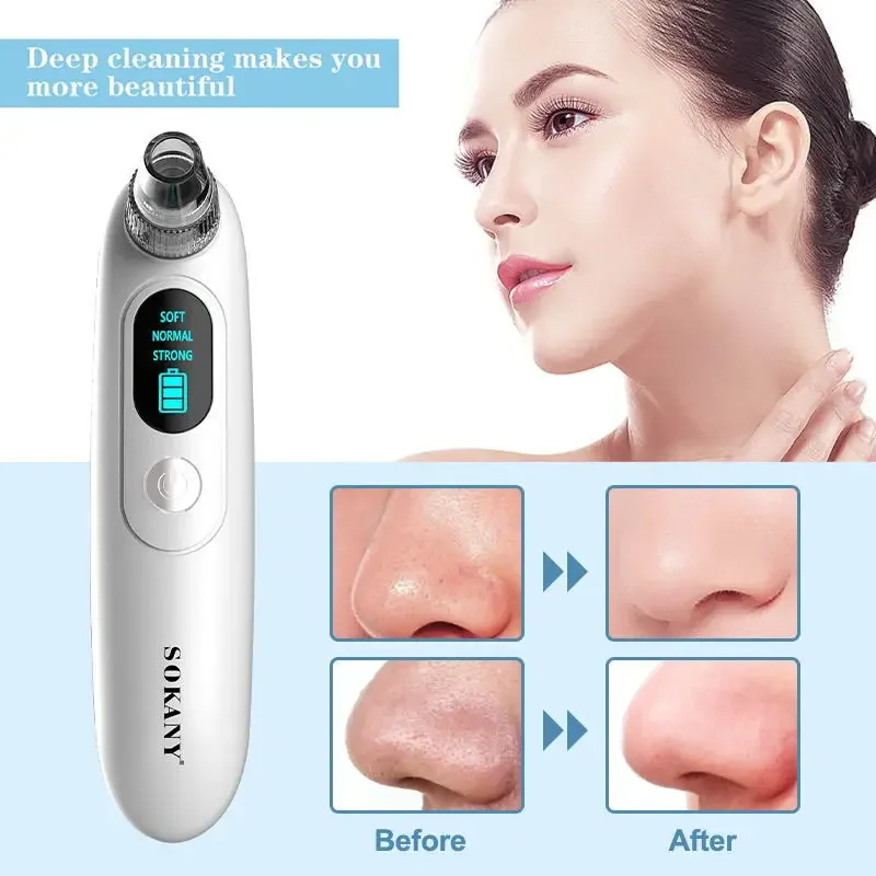 3 In 1 Electric Facial Blackhead Remover Vacuum Pore Cleaner Acne Cleanser Black Spots Removal Face Nose Deep Cleaning Tools