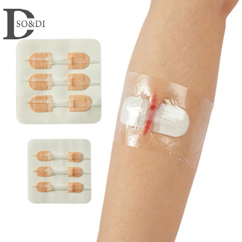 Zipper Tie Wound Encerramento Band-Aid, remendo hemostático portátil, sutura rápida, ao ar livre, 3pcs