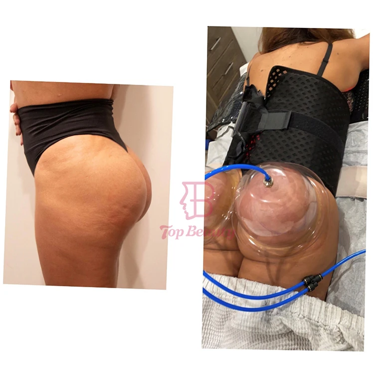 Physical Breast Enlarger Vacuum Cupping Therapy,natural Breast Enlargement Machine,professional Big Breast Machine
