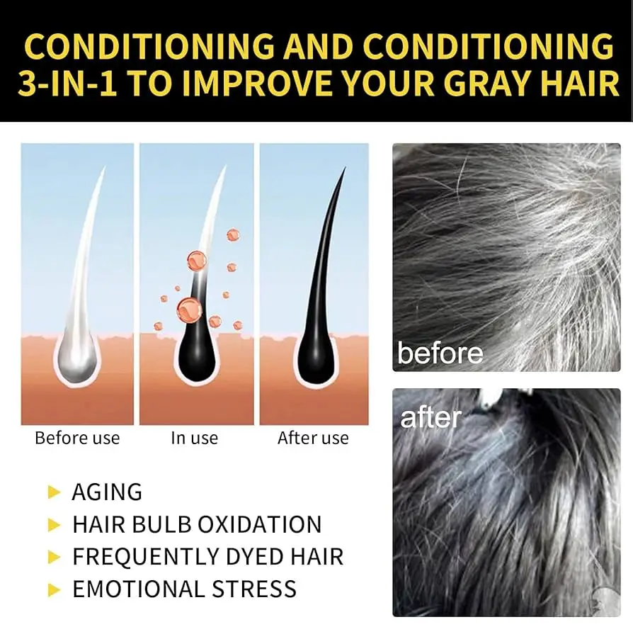 Gray White Hair Repair Serum Soap Fast White To Black Repair Nourish Beard Hair Roots Shampoo Men Women Beauty Health Care view 4