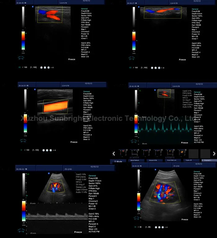 Hot Sale Sunbright 3D 4D ultrasound Machine 19