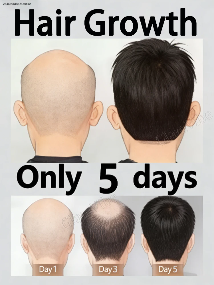 

A+ grade, suitable for all hair types: Fast-acting spray—your best choice!