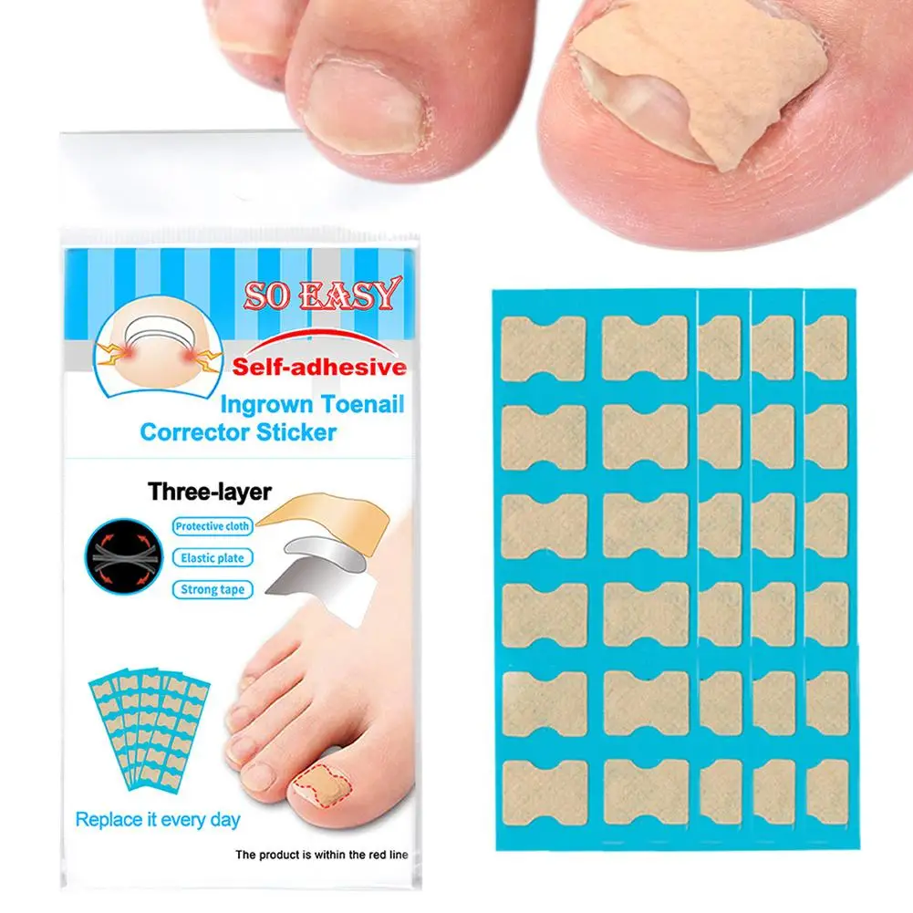 

Nail Fungus Patch Waterproof Nail Repair Patch Ingrown Damaged Sticker Patch Correction Gray Nail Care Q0G2