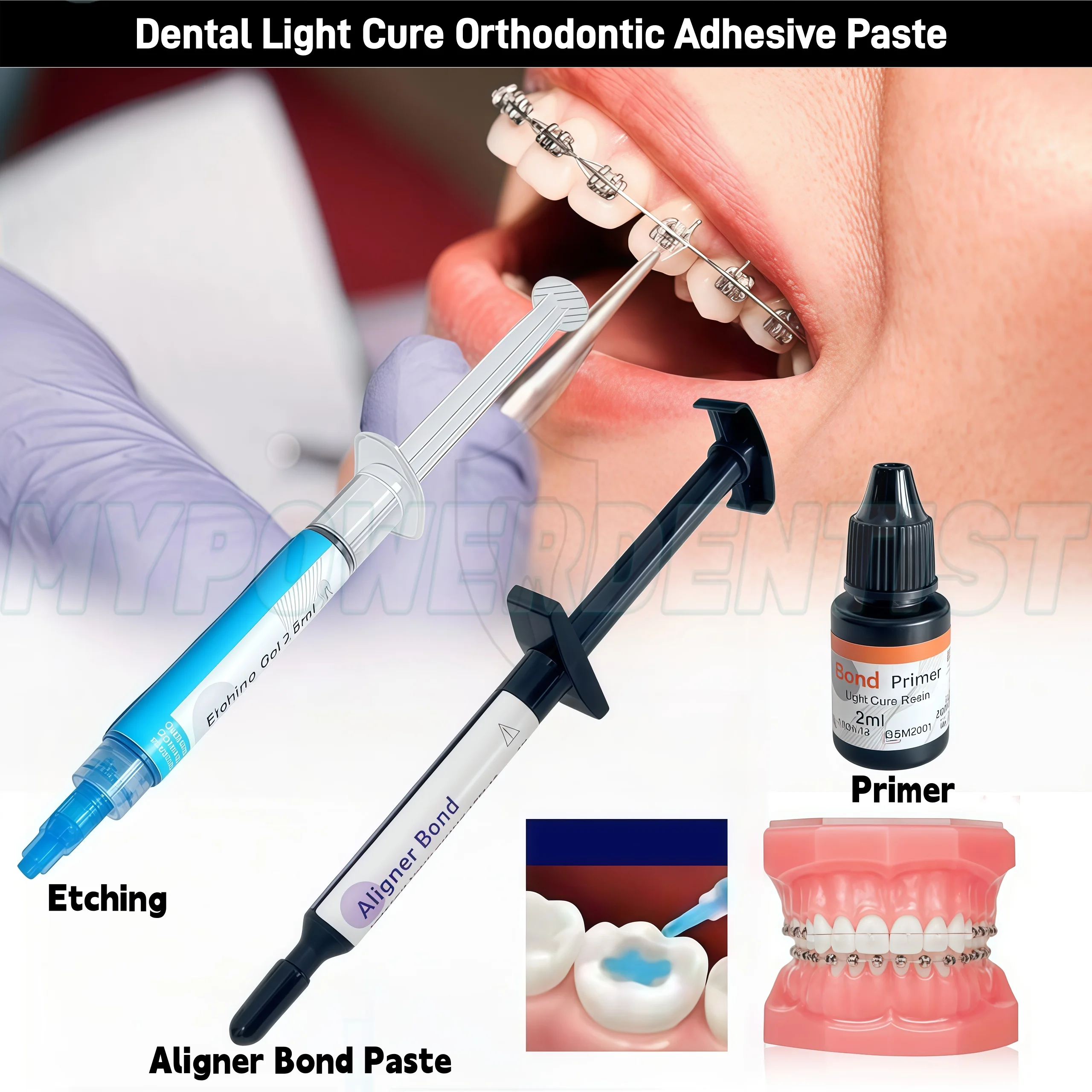 

1Kit Dental Light Cure Orthodontic Adhesive Paste for Aligner Attachments 2.5g