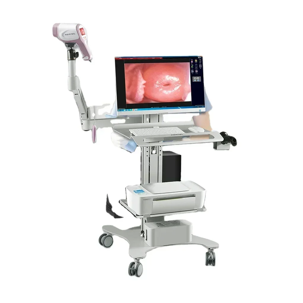 High Quality Digital Electronic colposcop Kolpos Copy Device for  Gynecology