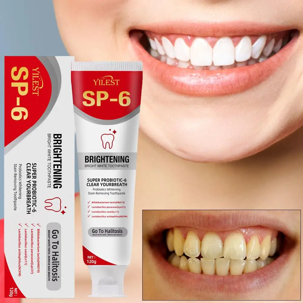 Pasta de dientes probiótica de SP-6 de alta gama, pasta de dientes Ultra blanqueadora, limpia manchas, cuidado bucal, probióticos, 120g, F0N1