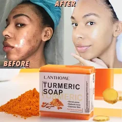 Ginger Handmade Soap Turmeric Soap Face Cleansing Anti Acne Whitening Skin Lightening Face Remove Pimples Dark Spots Lightening