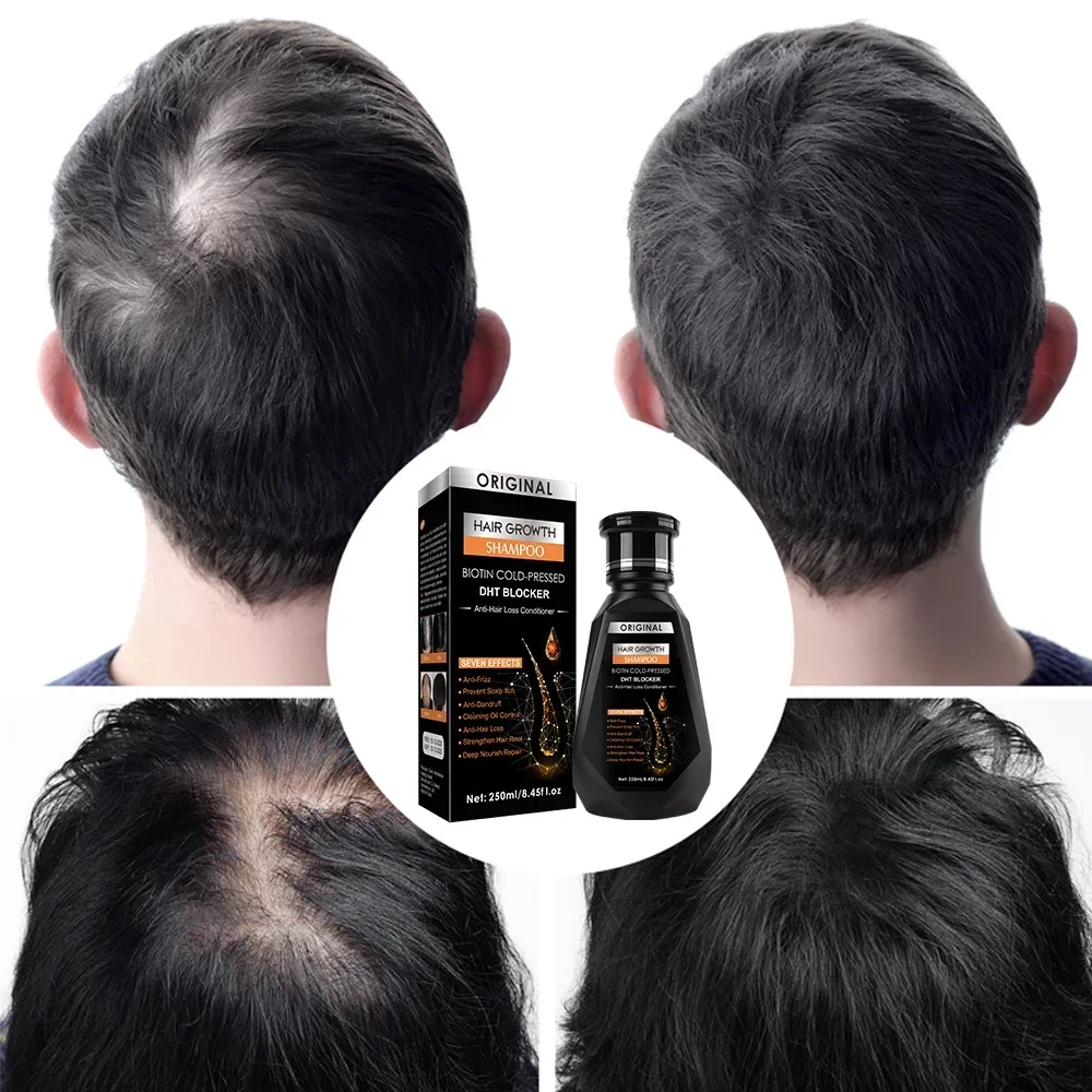 Hair Growth Ginger Shampoo Biotin Cold-pressed Anti-hair Loss Conditioner Massage Cream Hair Treatment for Hair Regrowth Care