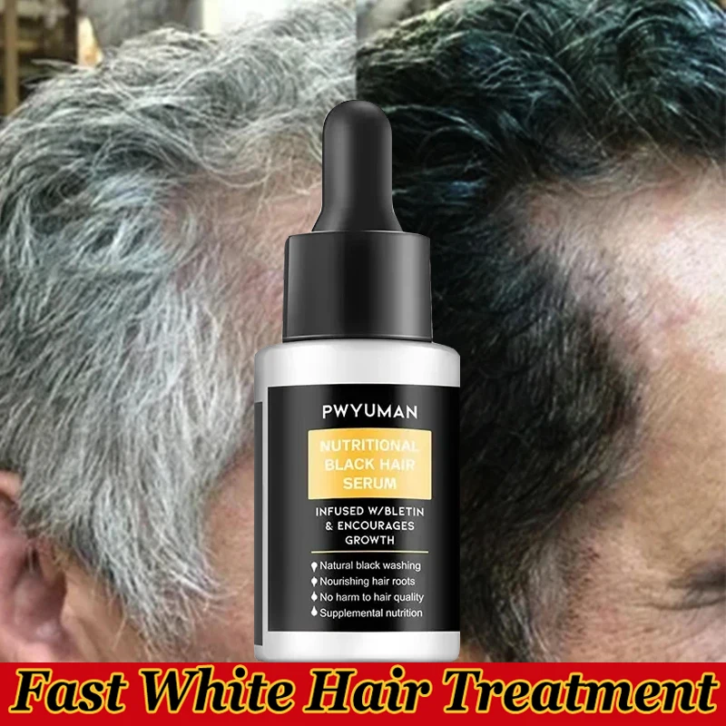 

Gray White Hair Treatment Serum White Black Natural Color Hair Growth Oils Fast Regrowth Anti Hair Loss Beauty Health Women Men