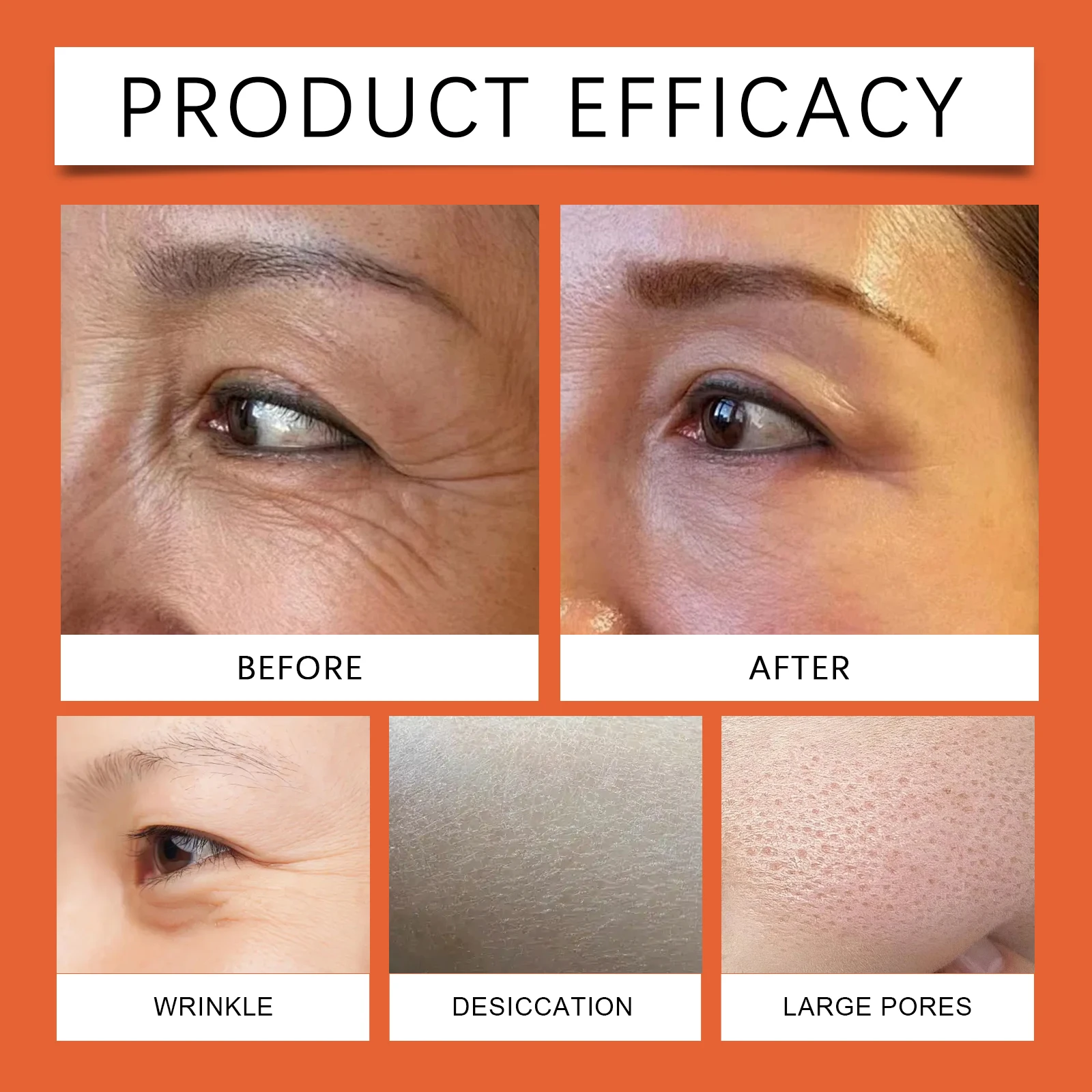 طبقة كولاجين للعين لشد البشرة وترطيبها وإزالة الهالات السوداء وتحسين تتلاشى الخطوط الدقيقة والتجاعيد ضد أكياس الانتفاخ هيدرات #6