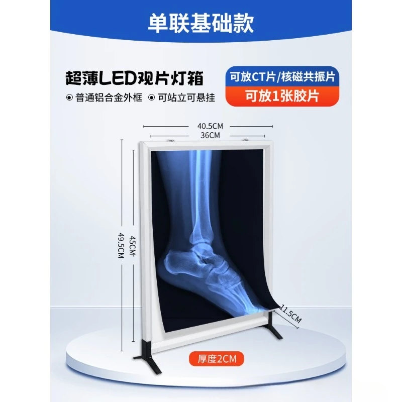 Genuine x-ray viewing light medical led ultra-thin viewing light box