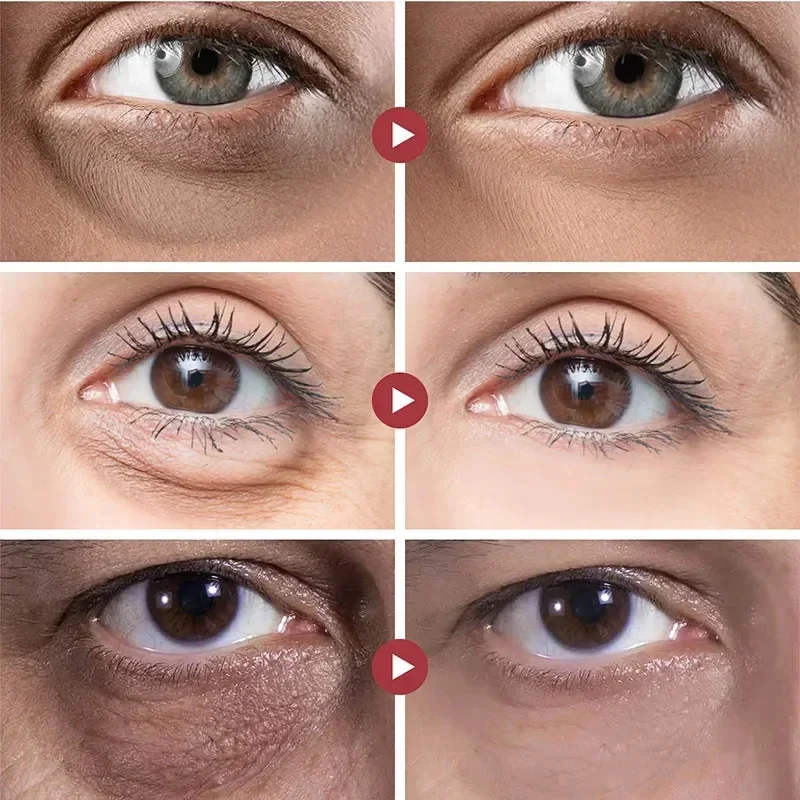 Crème raffermissante anti-âge pour les yeux, élimine les cernes, les poches, les granules de graisse, déformable, estompe les lignes fines, soins de beauté