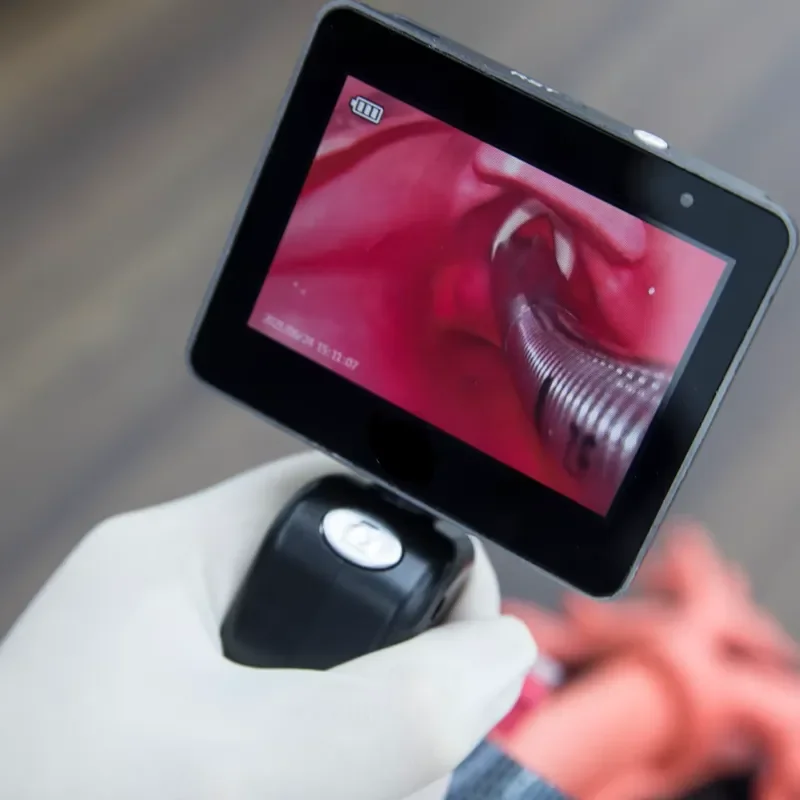 Portable Disposable Video Laryngoscope and Bronchoscope for Emergency Intubation – Single-Use Airway Device