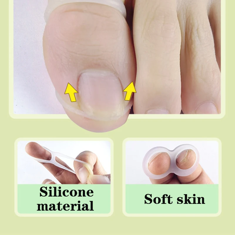 Silicone Ingrown Toenail Correction Pads Tool Invisible Ingrown Toe Nail Treatment Elastic Straightening Clip Brace