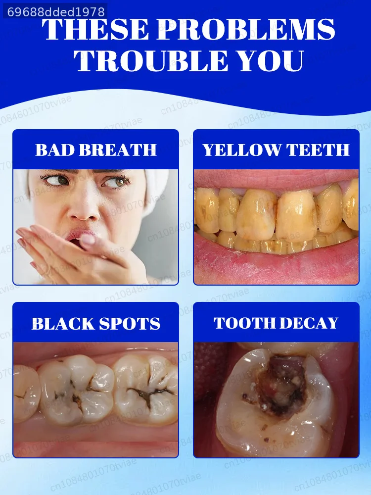 Teeth Whitening Toothpaste Deep Clean Plaque Removal Tartar Control Stain Remover Oral Hygiene Fresh Breath Brightening Smile Dental Care Daily Cleansing Anti Plaque Removes Soft Debris For Adult Men Women Beauty Health Care 60g