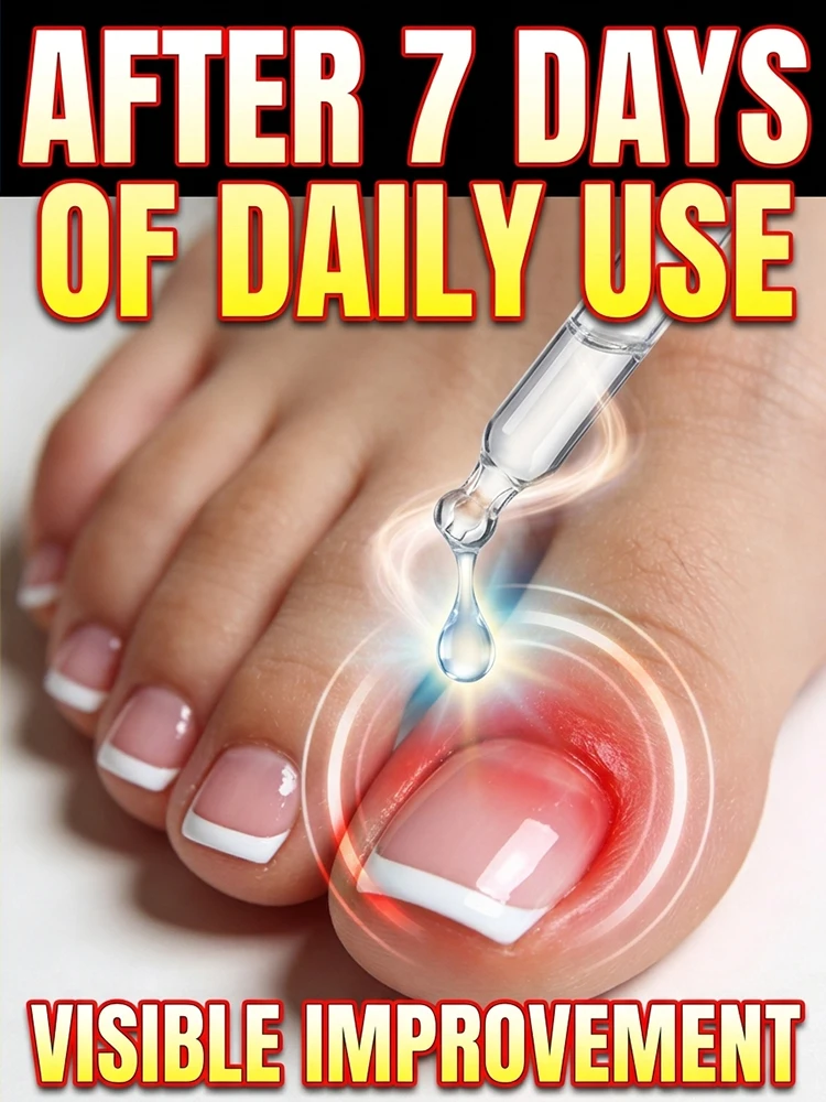 

2026Nᵃⁱˡ Fᵘⁿᵍᵘˢ Tʳᵉᵃᵗᵐᵉⁿᵗ,Oⁿʸᶜʰᵒᵐʸᶜᵒˢⁱˢ