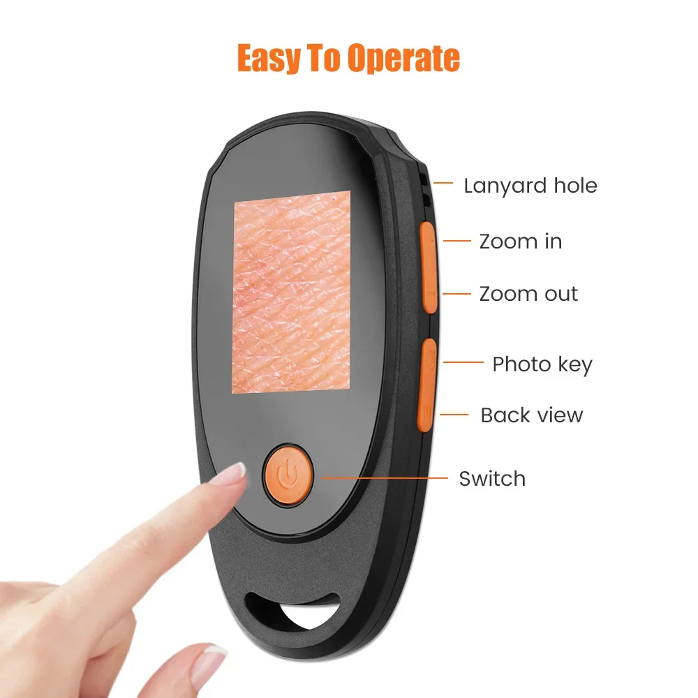 Dermatoscope Skin Analyzer Machine Digital Microscope Camera WiFi Wireless Electron Scalp Detection Pores Magnifier Facial view 6