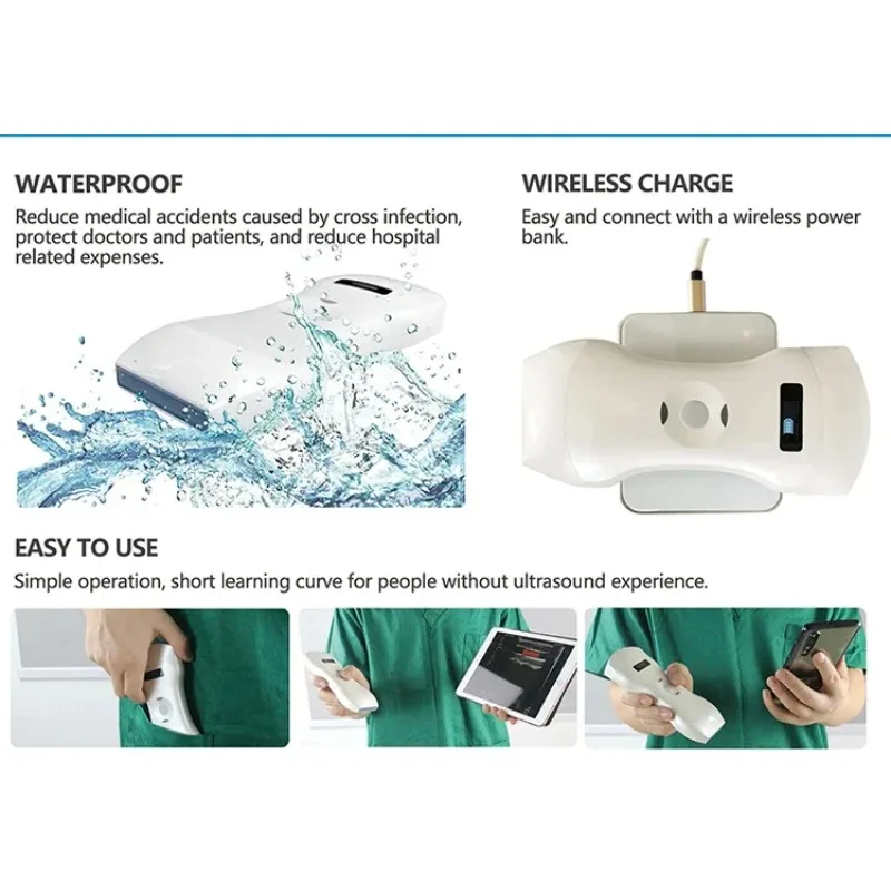 Portable Wireless Mini Ultrasound Diagnostic Equipment with Electric Power Source for Bladder Probe Medical Use