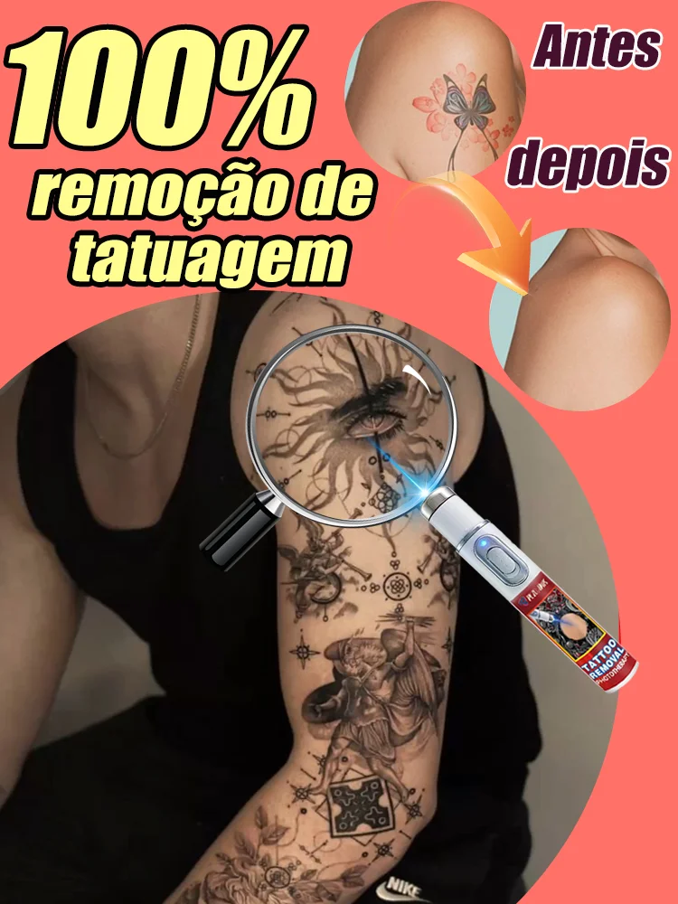 tᴀᴛᴛᴏᴏ-rᴇᴍᴏᴠᴀʟ-lᴀsᴇʀ-pᴇɴ-eғғᴇᴄᴛɪᴠᴇʟʏ-rᴇᴍᴏᴠᴇs-pᴇʀᴍᴀɴᴇɴᴛ-tᴀᴛᴛᴏᴏs