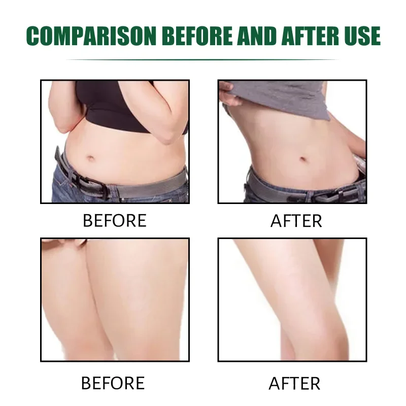 Ginger Slimming Cream 7 Days Weight Loss Remove Waist Leg Anti Cellulite Burning Fat Body Shaping Slime Health Care Tool Detox