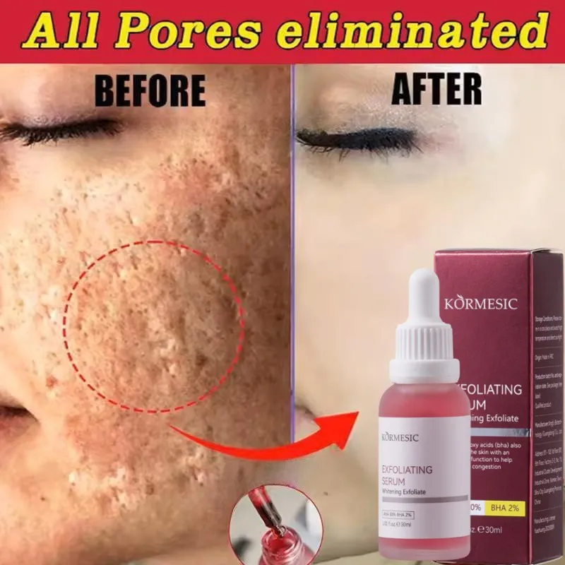 

Fast Pore Shrinking Serum Blackhead Removal Peeling Exfoliation Essence Oil Control Moisturize Smooth Lift Firm Korean SkinCare