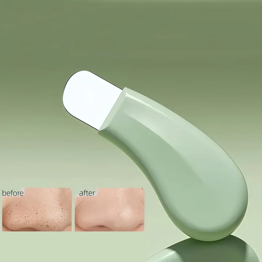 Nieuwe handmatige comedondrukkerspatel, gezichtsporiereinigingshulpmiddel voor mee-eters en acne, draagbare huidschraper