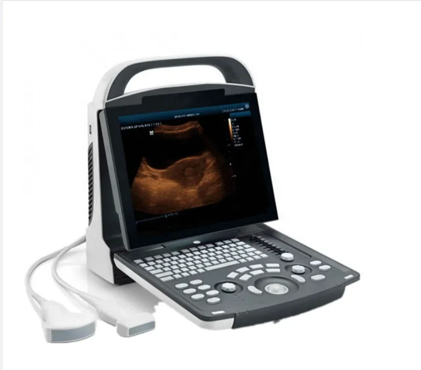 Mindray Portable Black White Ultrasound Machine DP-10