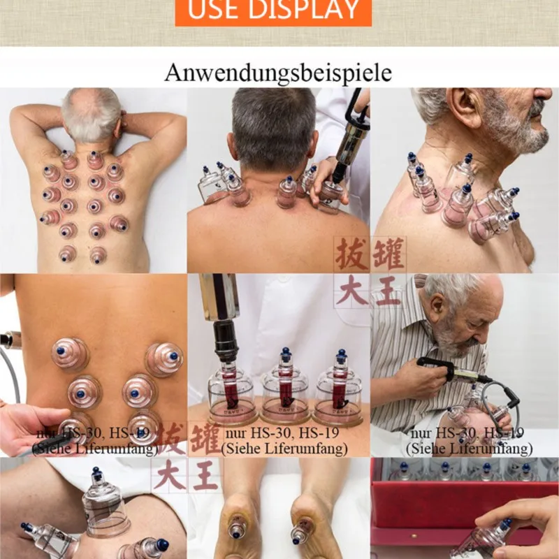 مجموعة خزان الحجامة المنزلية الراقية 19 علبة تنفيس صف الدم خزان الوخز بالإبر تدليك الصحة